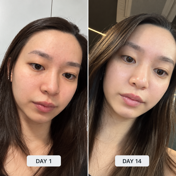 My Skin Looks Radiant Now!